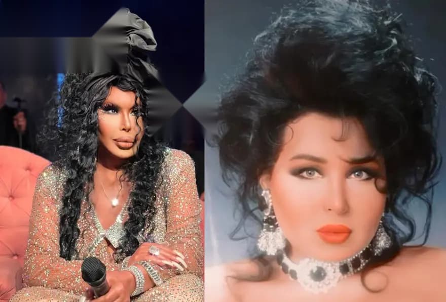 Bülent Ersoy 74 yaşında estetik operasyon geçirdi — görsel 3